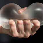 mastoplastica preservé