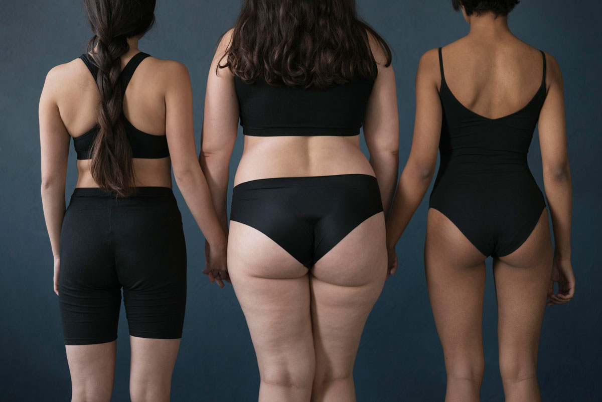lipedema cause
