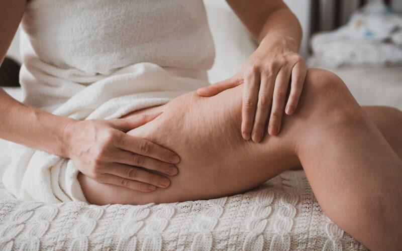 lipedema e linfodrenaggio