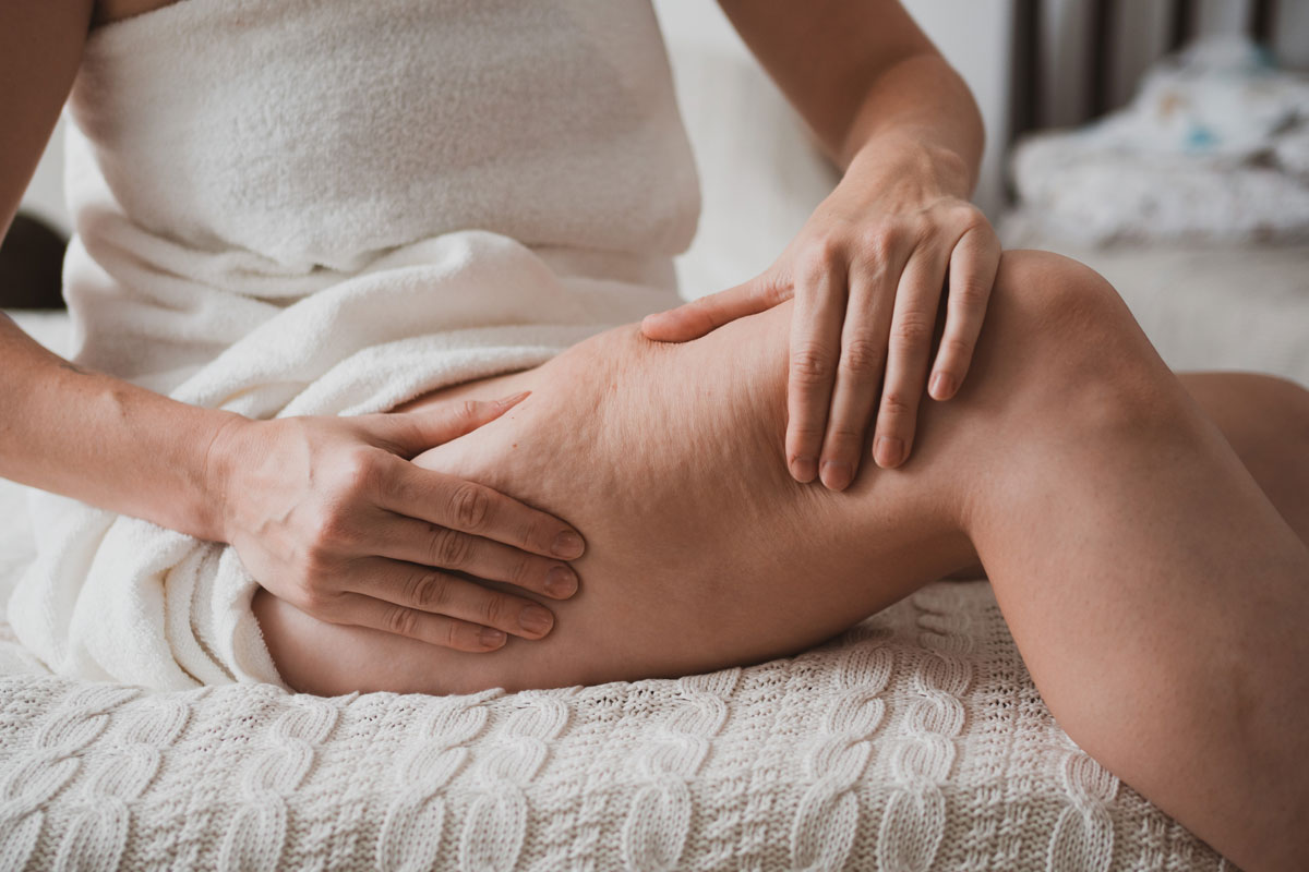 lipedema e linfodrenaggio