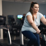 Lipedema o obesità