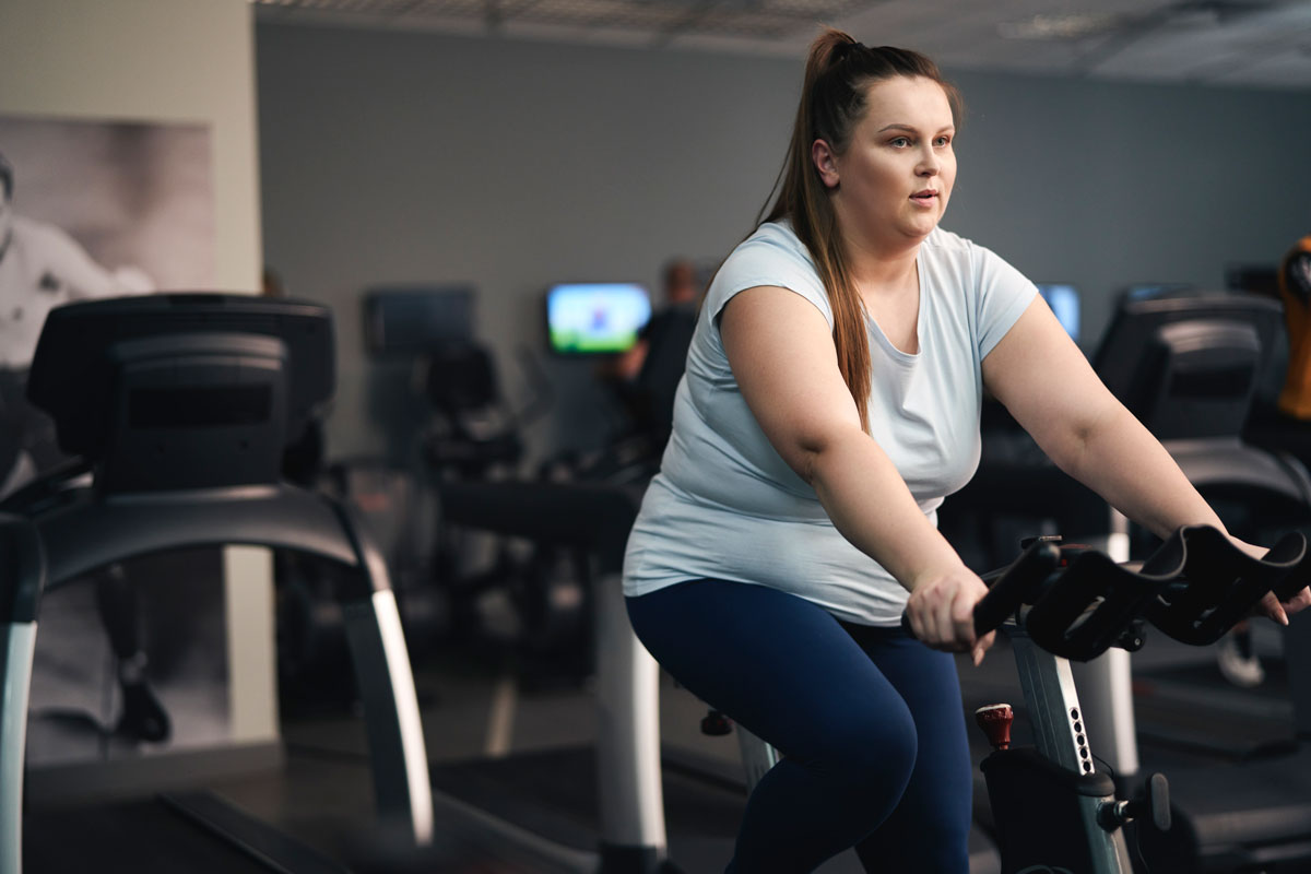 Lipedema o obesità